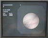 Olympus Bronchoscope BF-XP160F Evis Exera 945858