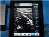 Bard Ultrasound Site-Rite 8 953296